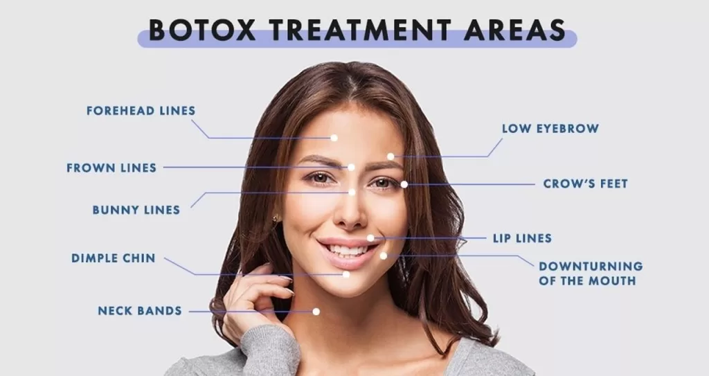 botox treatment areas website