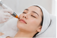 Hifu skin booster
